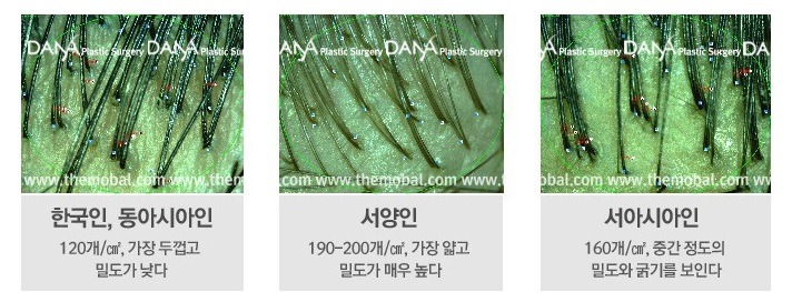 서양인 동양인 모발 차이 | 인스티즈