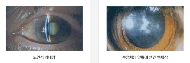 광주안과의원 이미지