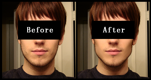 미국에서 은근히 많이하는 성형수술 세가지 | 인스티즈