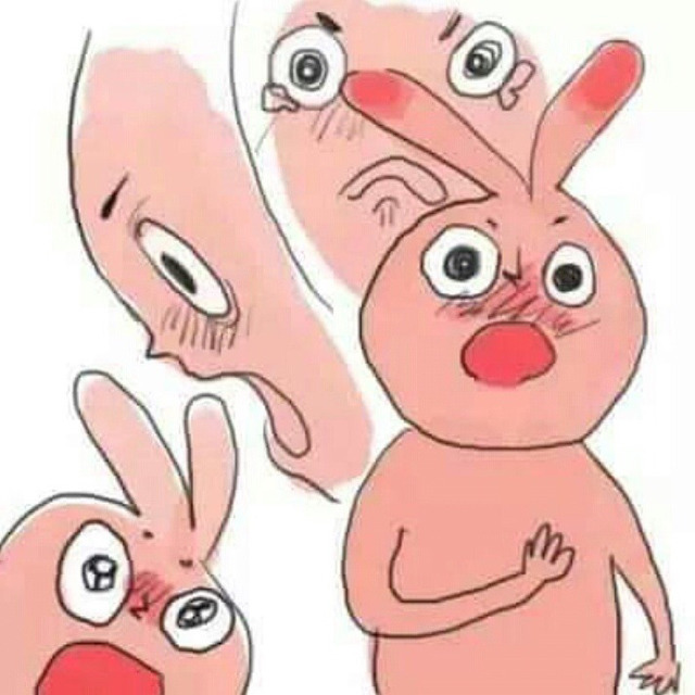 언더독 이미지
