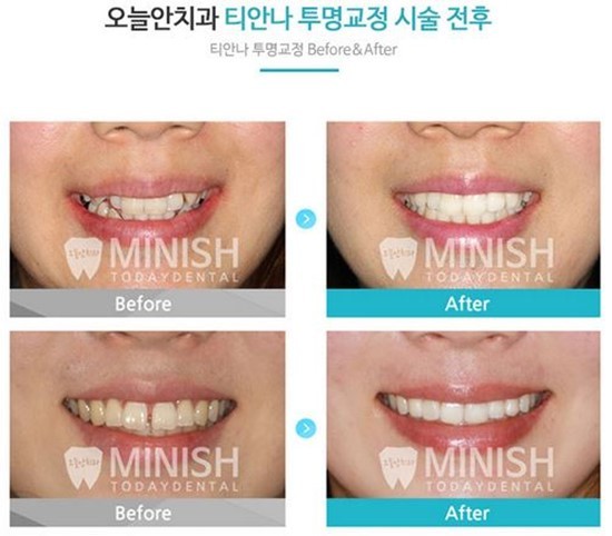 티안나 이미지