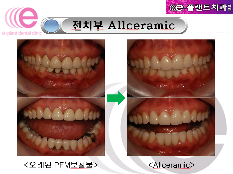 e-플랜트치과 이미지