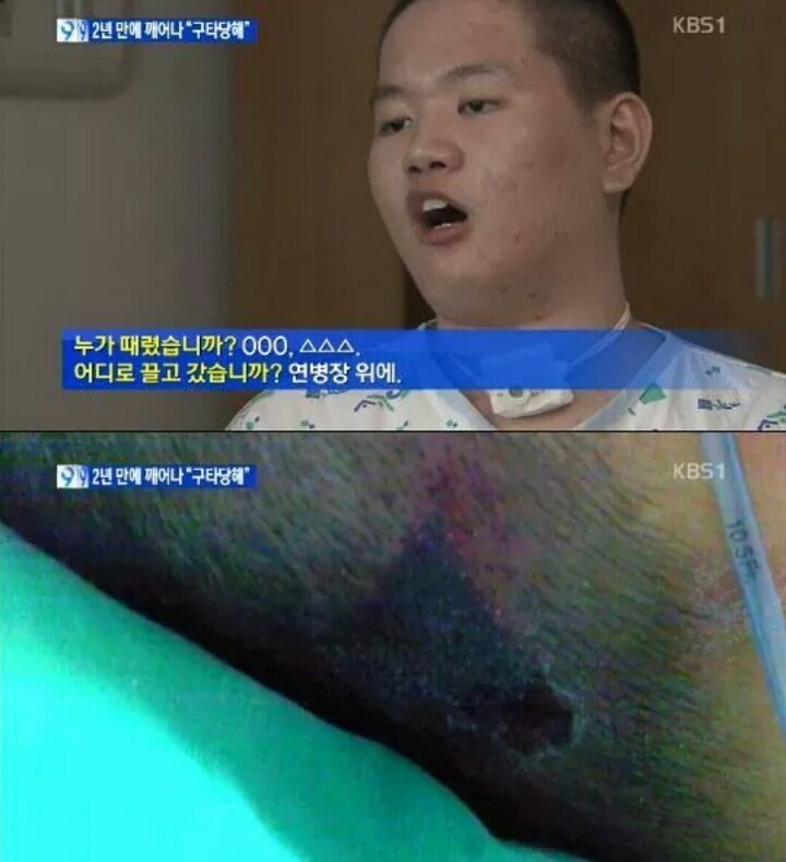 군대에서 식물인간이되서 2년만에 깨어난 청년의한마디 | 인스티즈