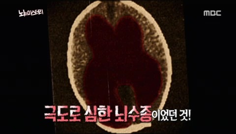 뇌의 미스테리 | 인스티즈