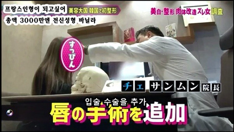 프랑스 인형이 되고싶어 총액 3000만엔 전신성형한 바닐라 | 인스티즈