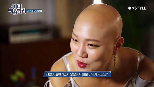 전신탈모증 윤사비나씨가 생각하는 아름다움.jpg | 인스티즈