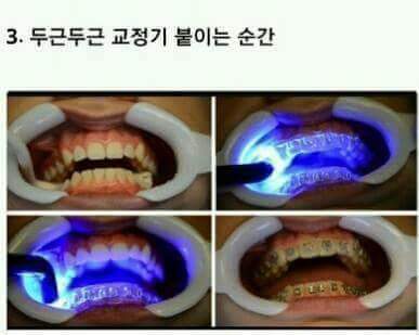 교정한 사람들은 공감하는것 | 인스티즈