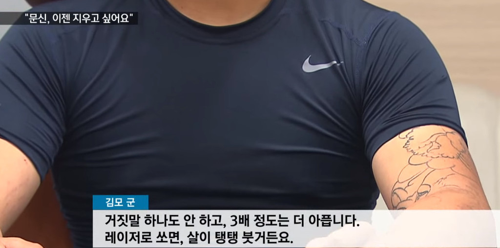 문신, 이제 지우고 싶어요! | 인스티즈